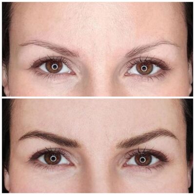 Microblading