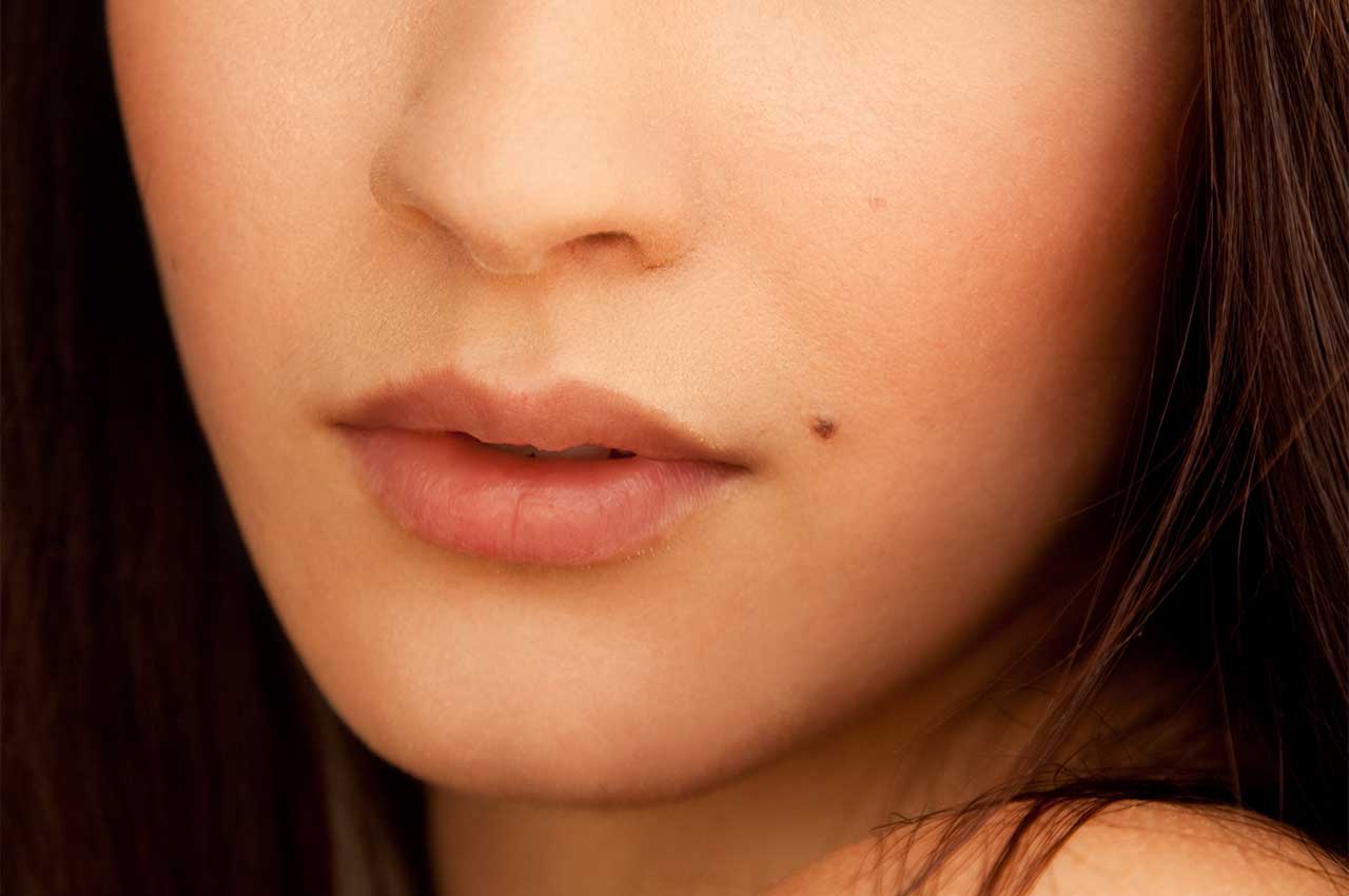 Understanding Beauty Marks: The Intriguing World Of Skin Moles And Freckles